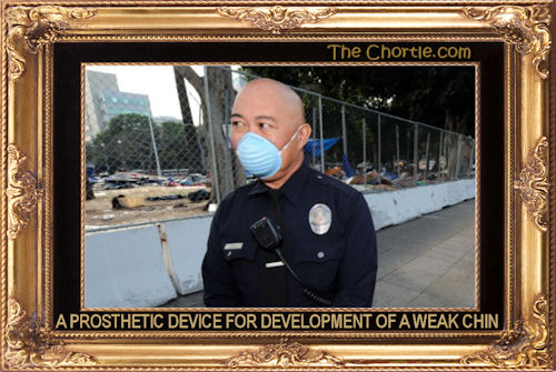 A prosthetic device for development of a weak chin