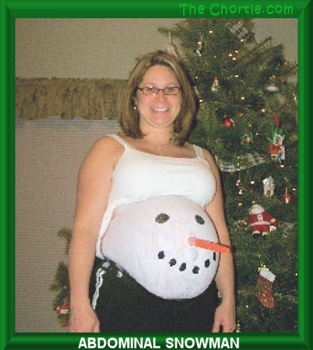 Abdominal snowman