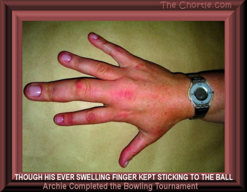 Though his ever swelling finger kept sticking to the ball, Archie completed the bowling tournament.