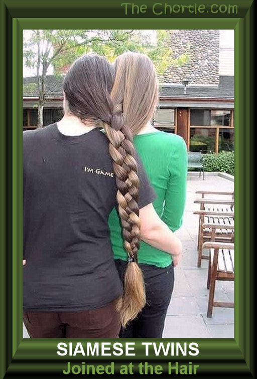 Siamese twins joined at the hair.