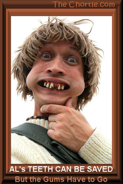Al's teeth can be saved, but the gums have to go. 