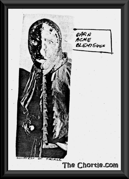 Darn acme blemishes (Courtesy of Tackle)