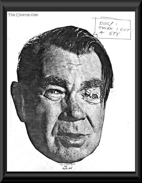 Doc. I think I got a sty. (Courtesy of Murine)