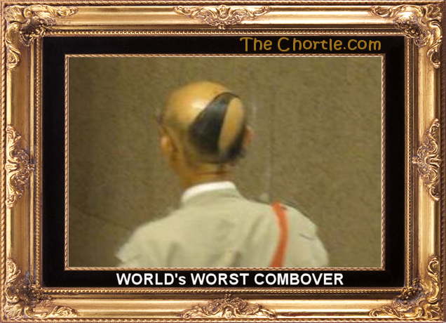 World's worst combover.