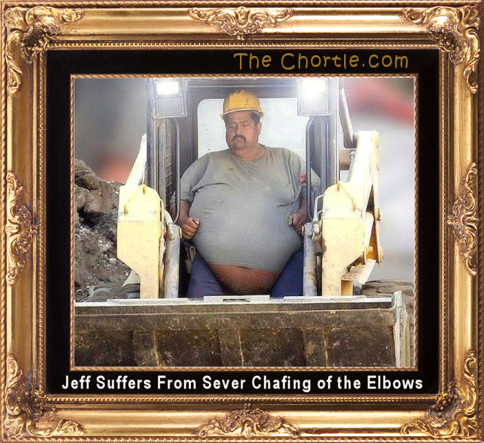 Jeff suffers from severe chafing of the elbows.