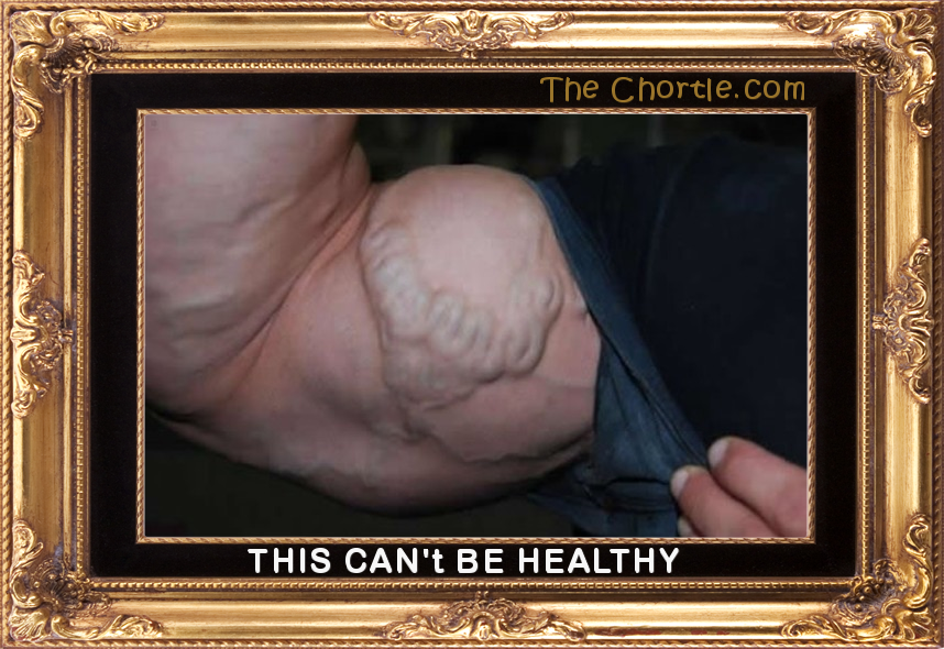 This can't be healthy