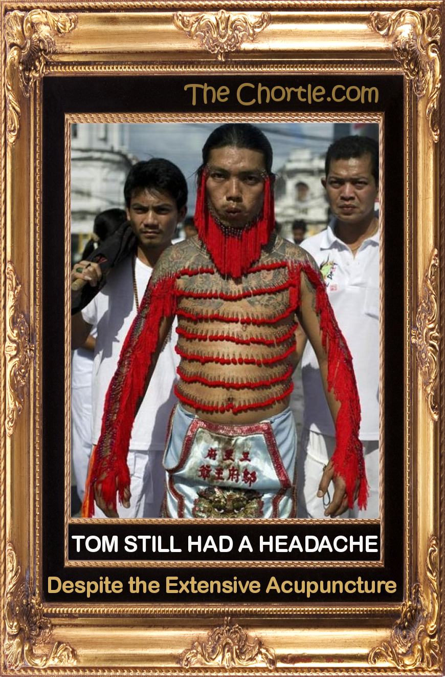 Bill still had a headache despite the extensive acupuncture.