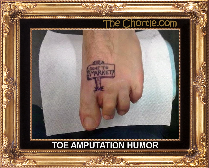 Toe amputation humor