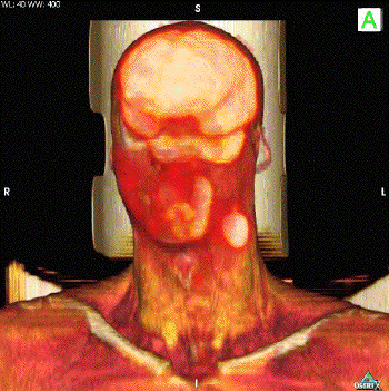 Animated PET Animated PET